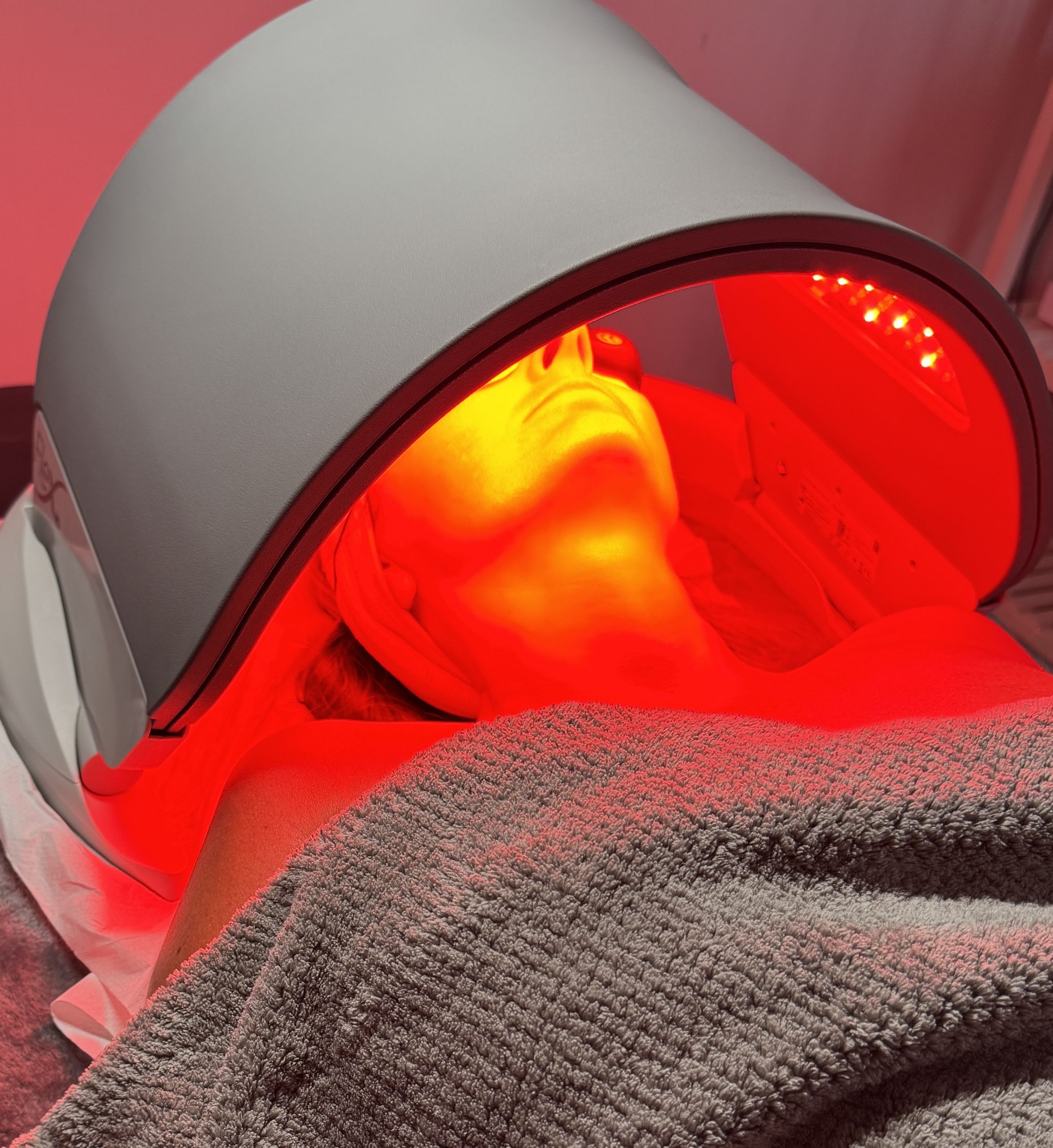 LED light therapy treatment