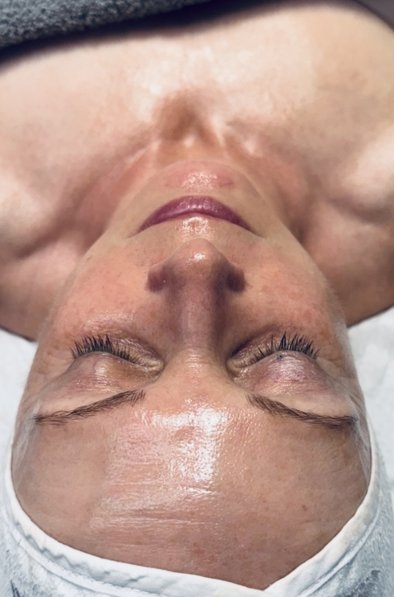 Professional Facial Treatment