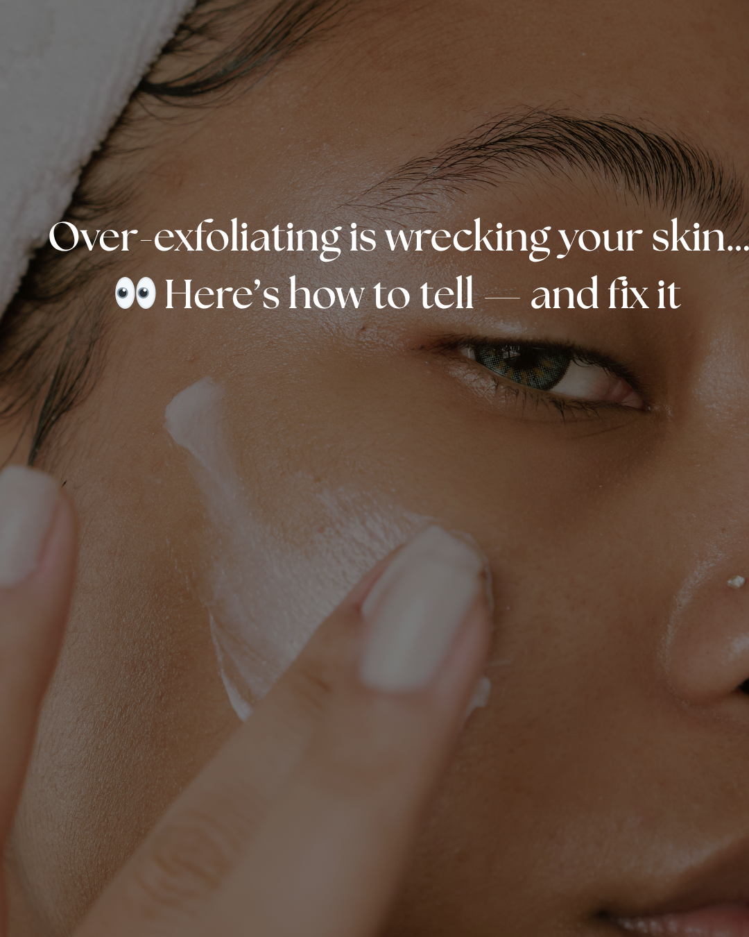 Signs of over-exfoliation